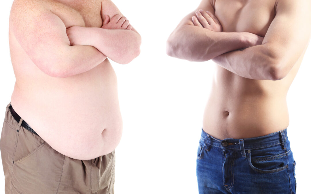 Gynecomastia Surgery Following Weight Loss