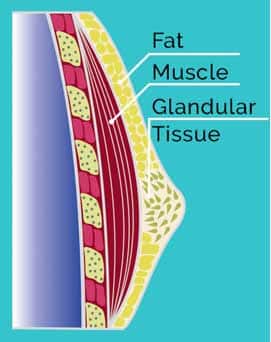 Gynecomastia Diagnosis Graphic