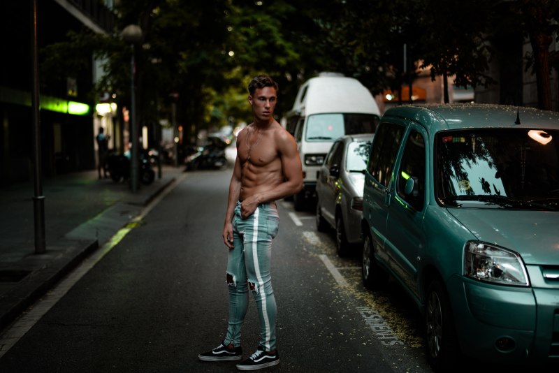 Paradoxical Adipose Hyperplasia: Side Effect of Pseudogynecomastia Treatment from Fat Freezing