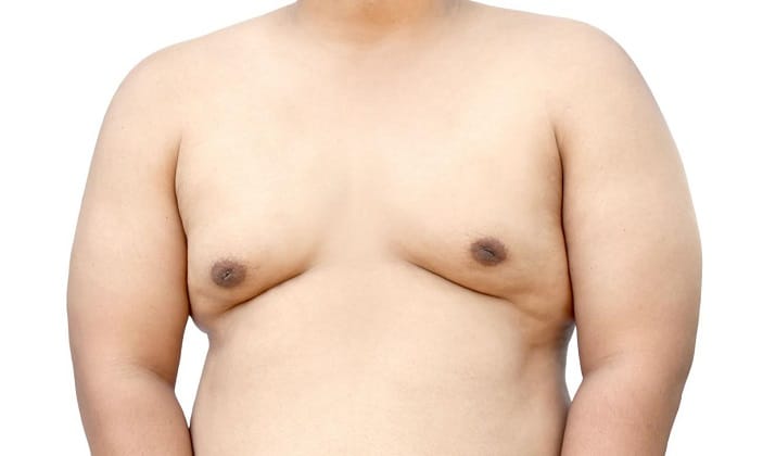 cost of male breast reduction