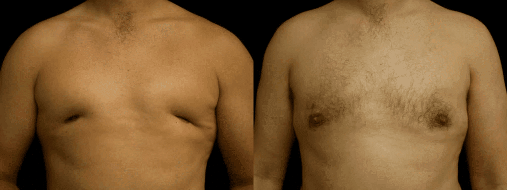 Actual patient results 5