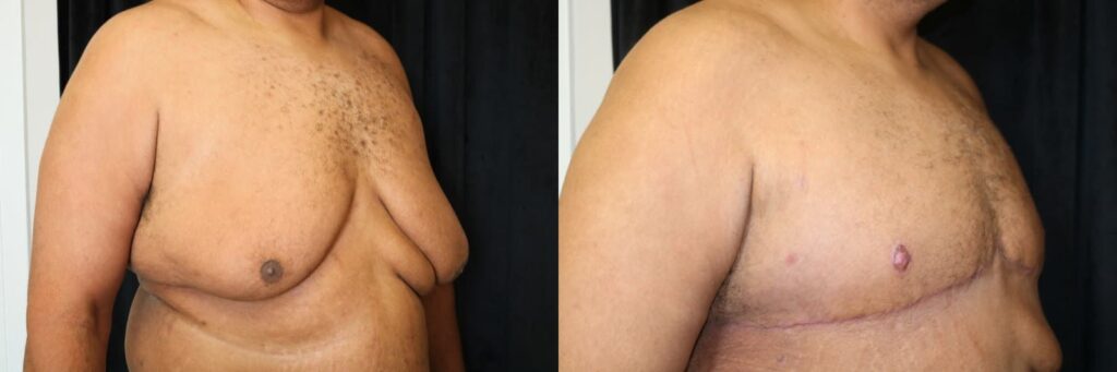 Actual patient results 4