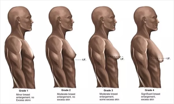 image(20)
