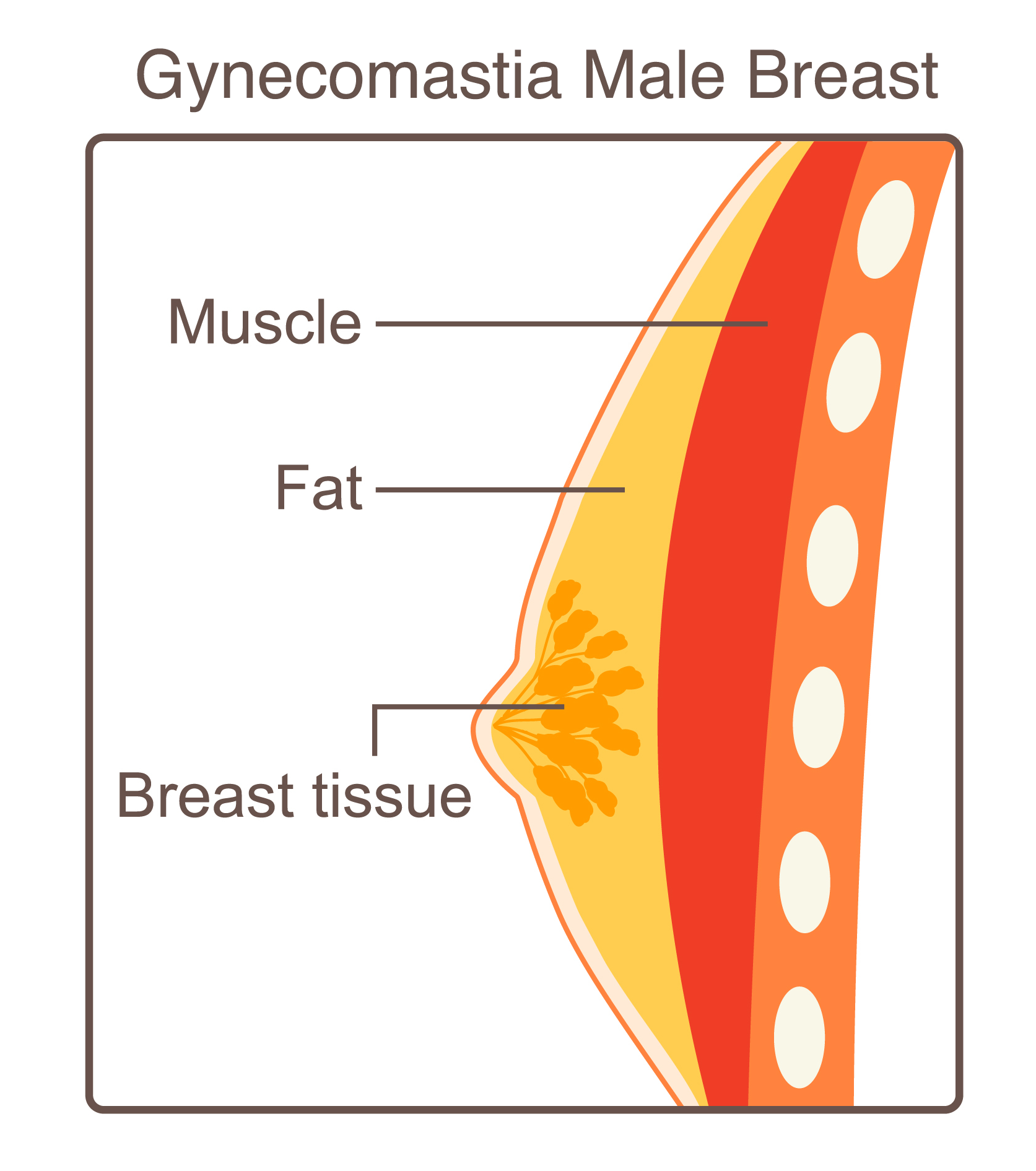 Male Breast Diagram 2