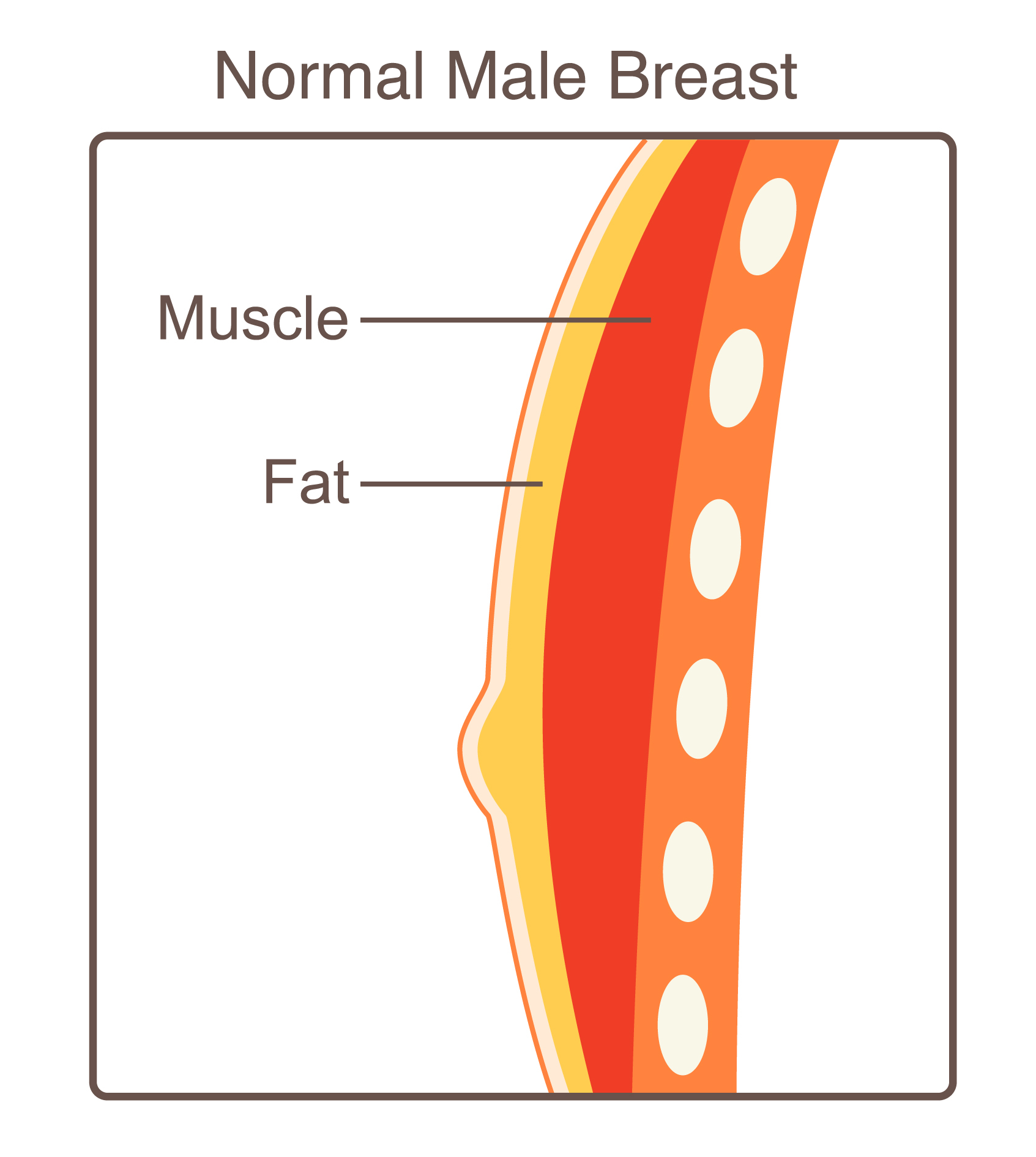 Male Breast Diagram 3