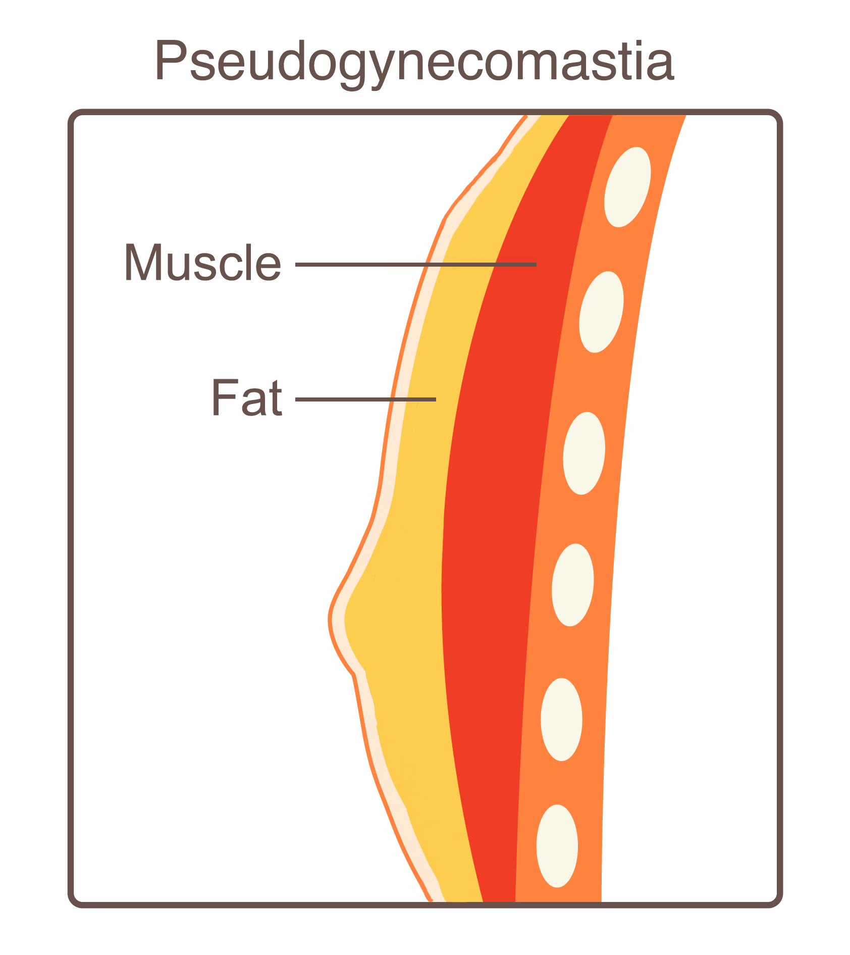 Male Breast Diagram 1