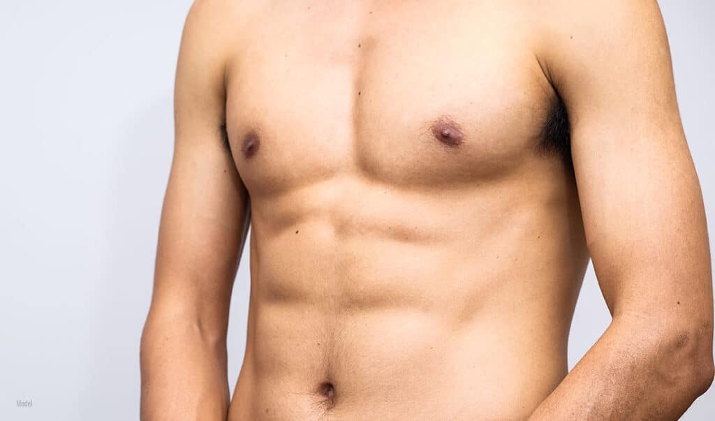 Do I Have Gynecomastia or Pseudogynecomastia?