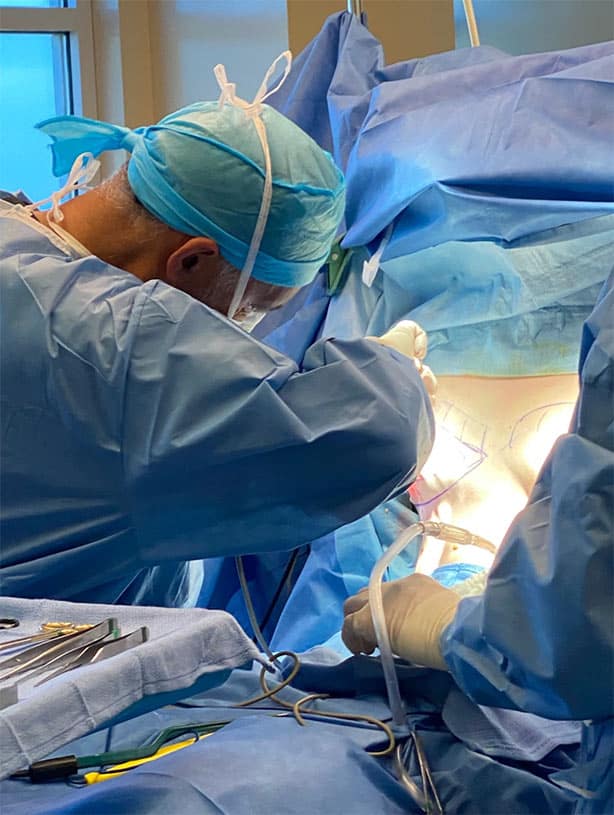 Dr. Delgado performing gynecomastia surgery.