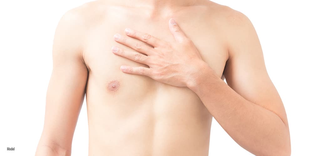 The Ultimate Guide to Preparing for Gynecomastia Surgery Consultation to Recovery